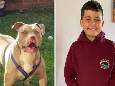 victim of attack by american xl bully